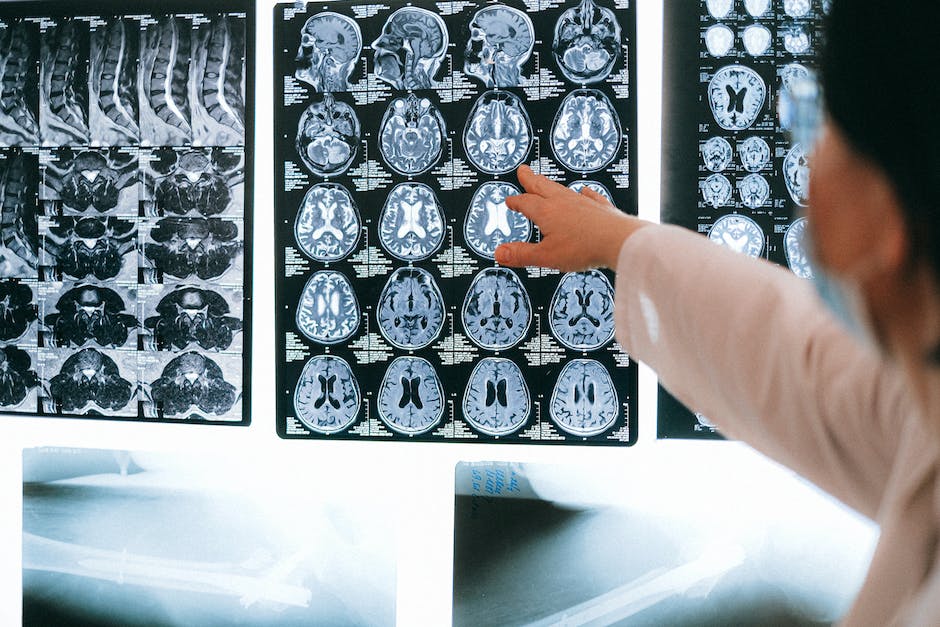 Radiologie-Medizin: Fachgebiet der medizinischen Diagnostik und Behandlung mithilfe von Strahlung